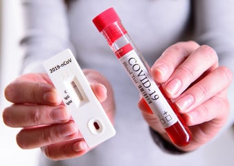 Covid19 Test